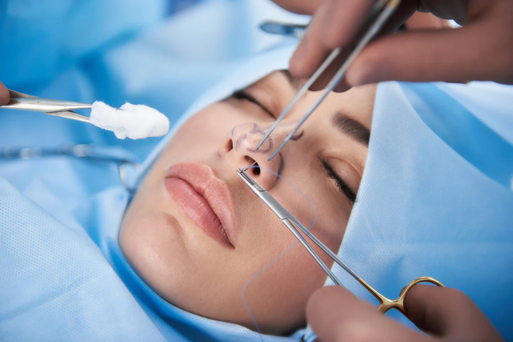 Rinoplastia